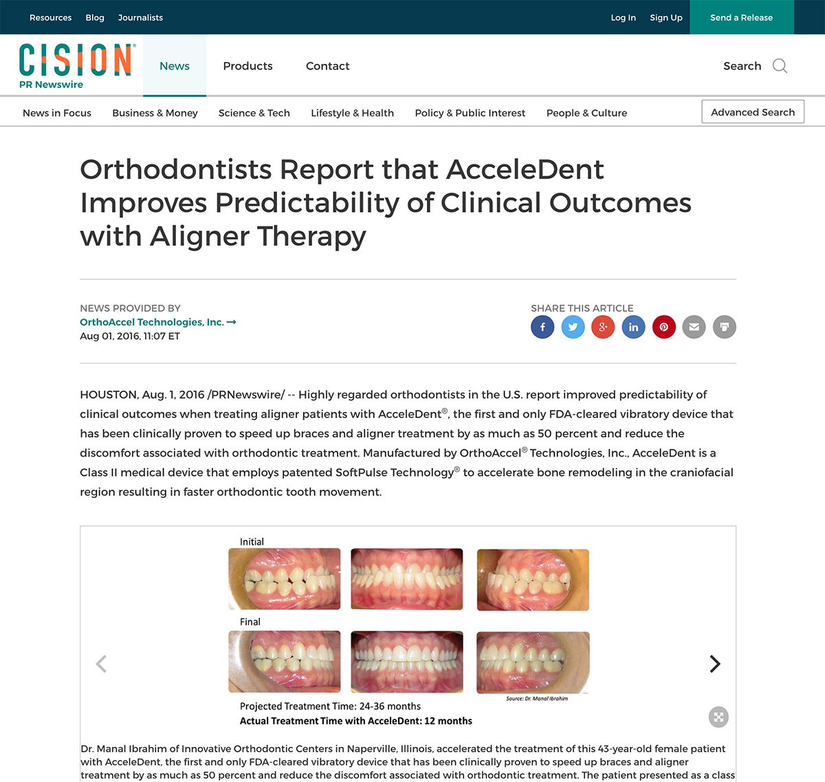 AcceleDent-Improves-Predictability-of-Clinical-Outcomes-with-Aligner-Therapy