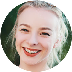 type-of-braces-metal