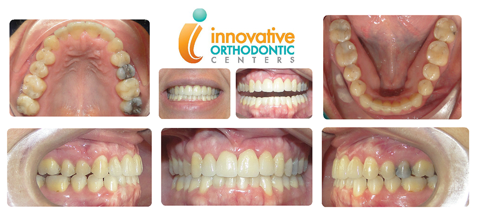 Innovative Orthodontic Centers - Before & After