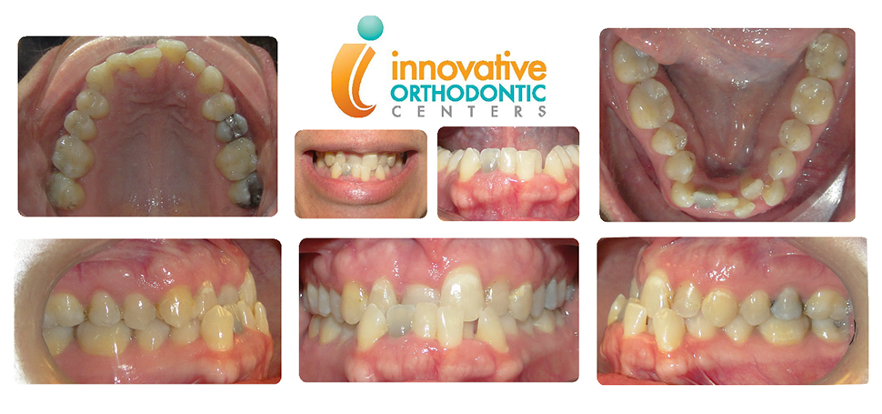 Innovative Orthodontic Centers - Before & After