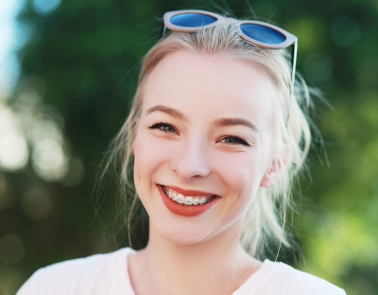 girl smiling how braces can affect faces