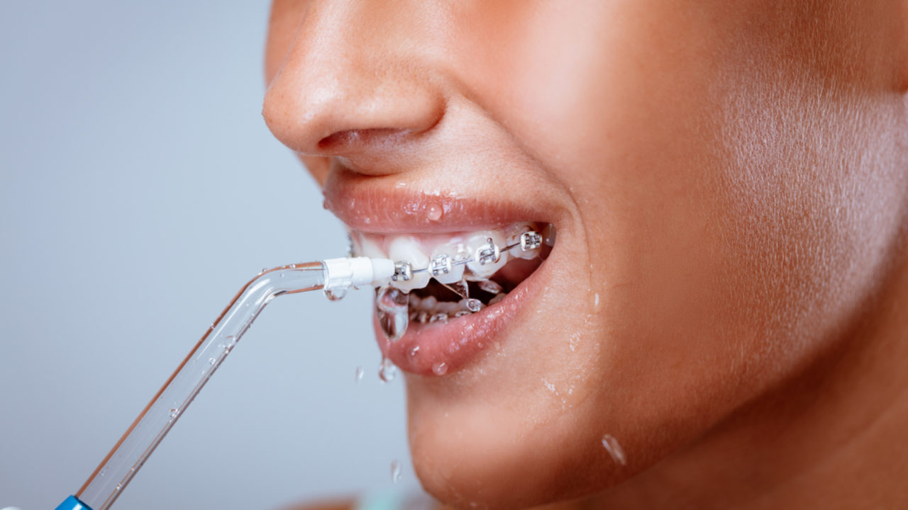 waterpik toothbrush for braces