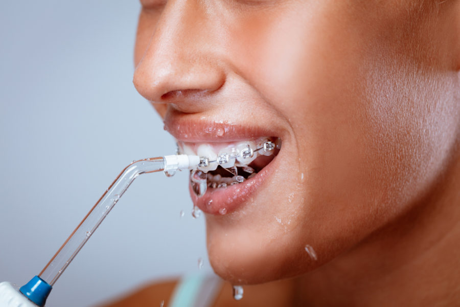 Is it Safe to Use a Waterpik for Braces?