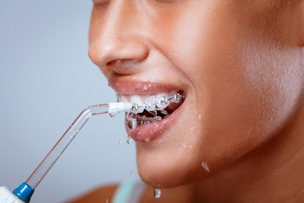 patient using Waterpik to clean teeth with braces