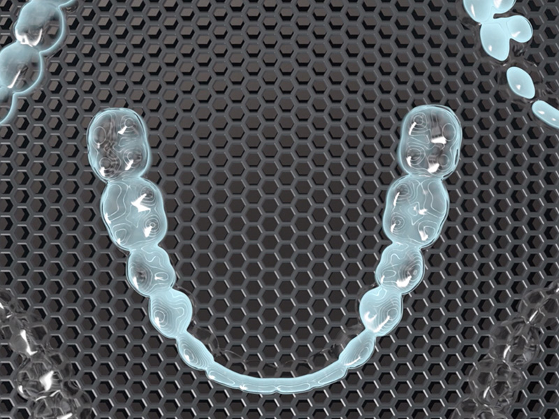 Invisalign Teen