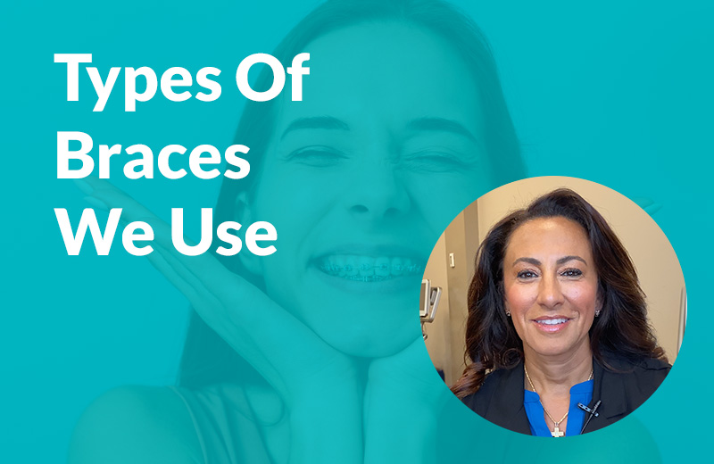 Types Of Braces We Use