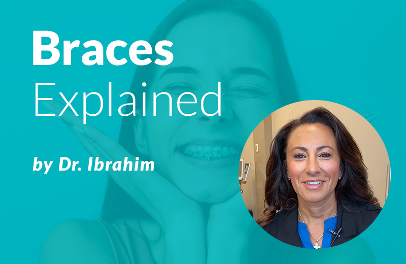 Braces Explained