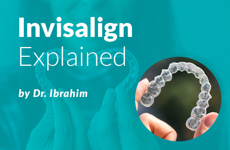 invisalign Explained
