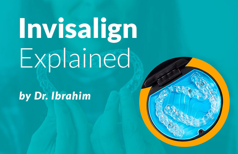 Invisalign Explained