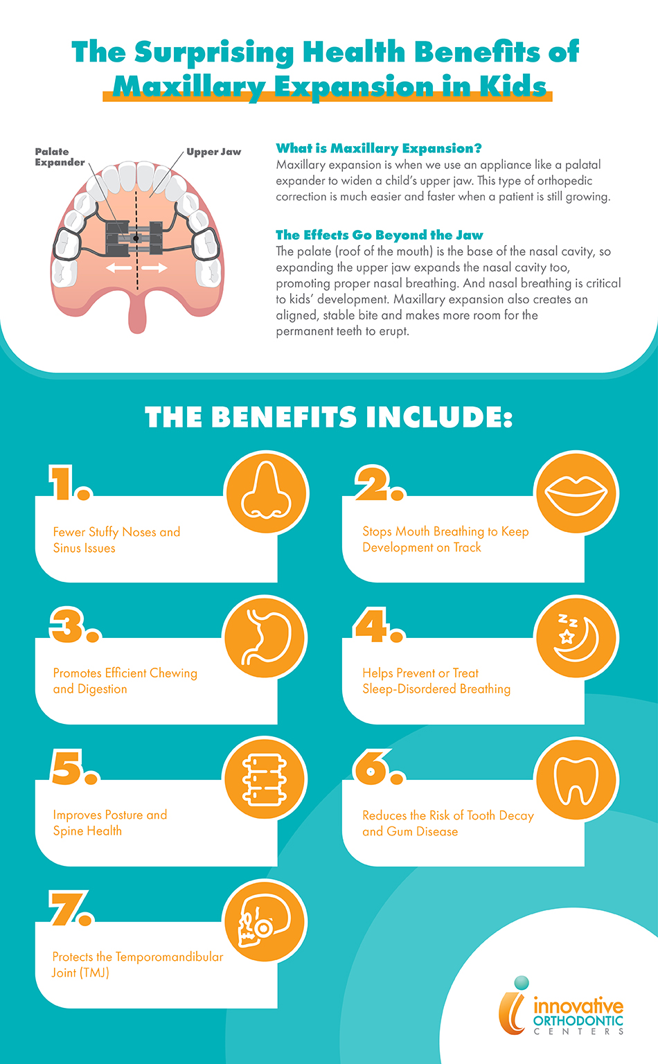 Health Benefits of Maxillary Expansion