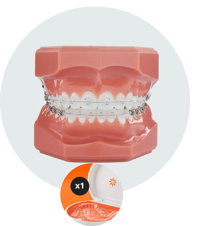 Invisalign
