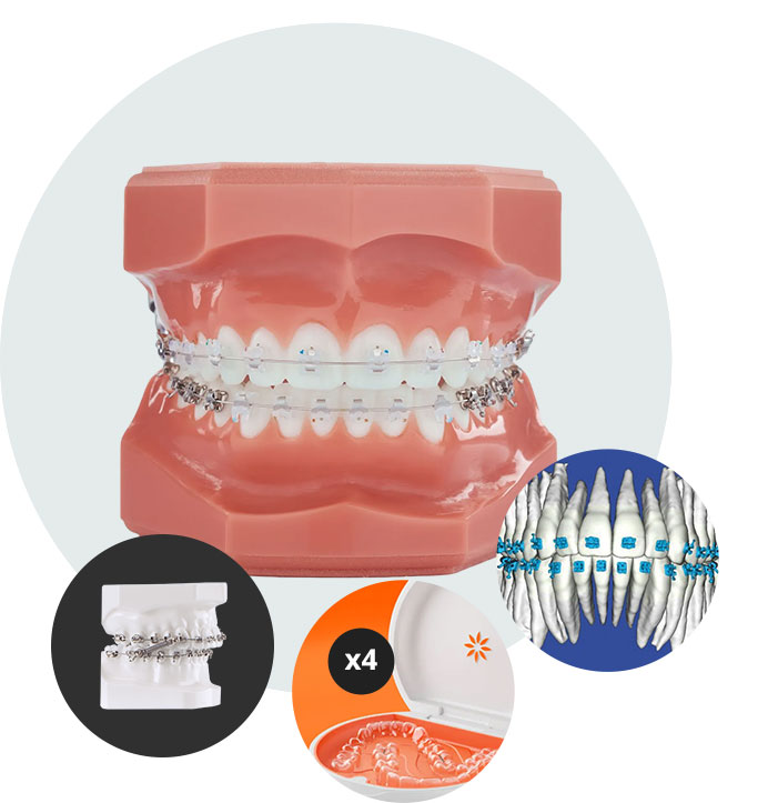 Invisalign