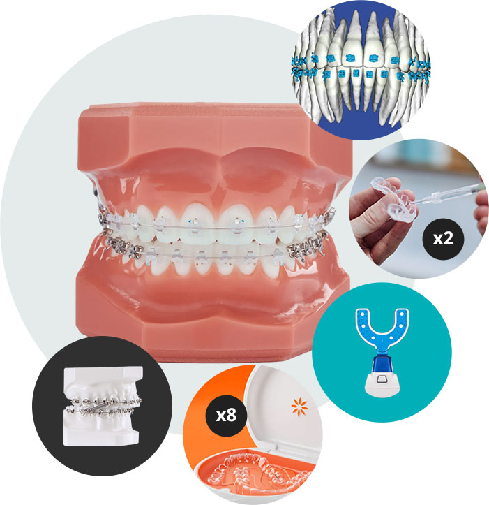Invisalign