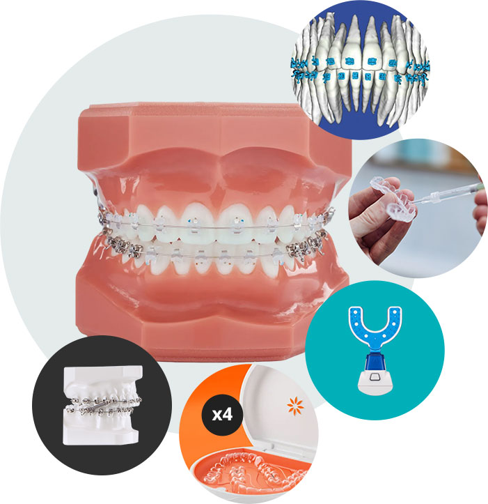 Invisalign