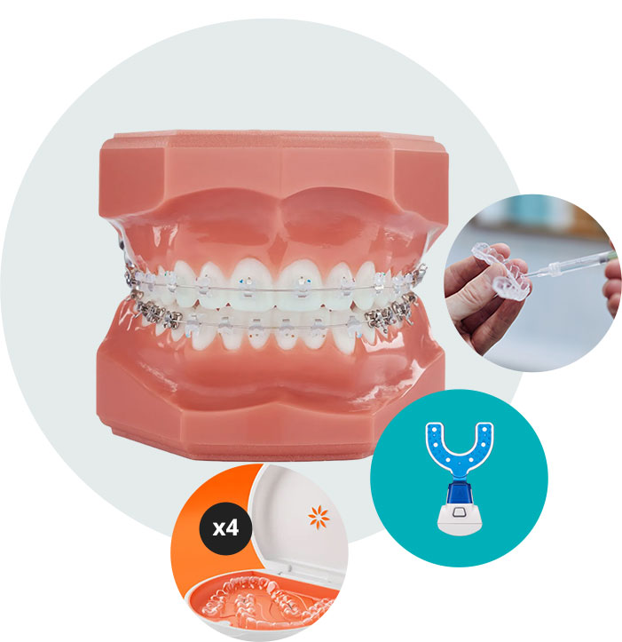 Invisalign