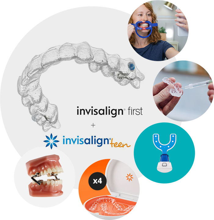 Invisalign