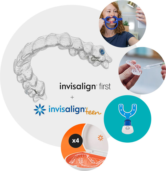 Invisalign