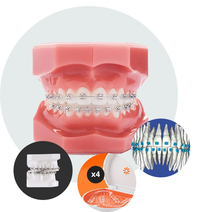 Invisalign
