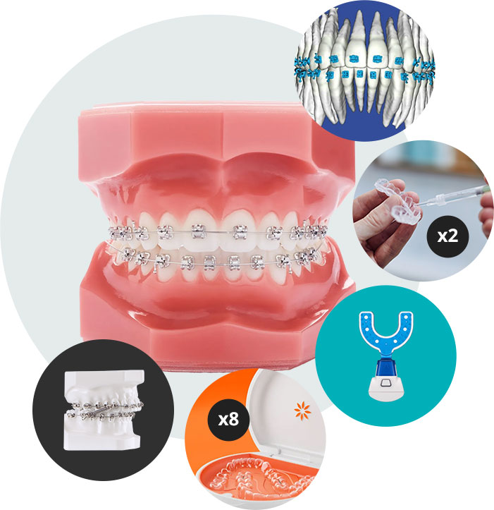 Invisalign