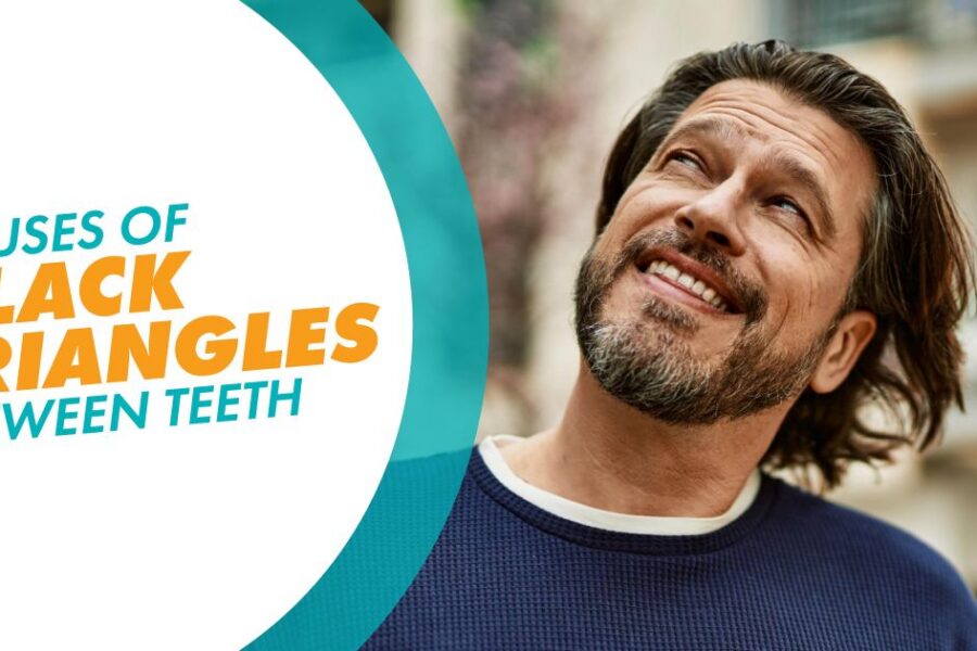 A man looking up and smiling with a text overlay that says "Causes of Black Triangles Between Teeth