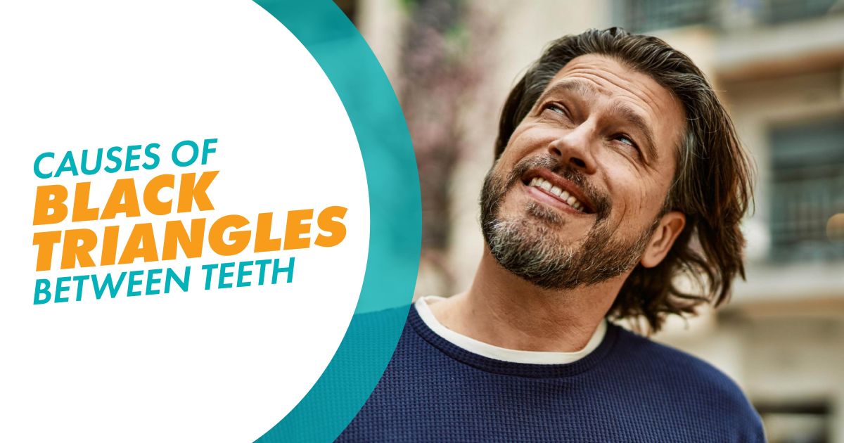 A man looking up and smiling with a text overlay that says "Causes of Black Triangles Between Teeth